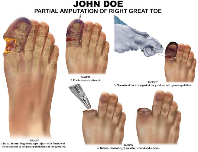 Procreate &amp; Illustrator, 2023