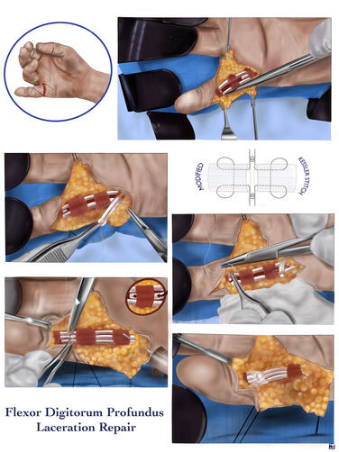 Procreate &amp; Illustrator, 2023