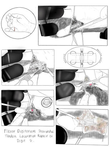 Surgical Illustration Draft